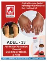 ADEL 33 - Oedema Drops - Image 2