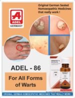 ADEL 86 - Warts (External) - Image 2